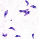 Toxoplasma gondii